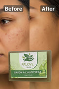 Savon aloe Vera anti taches